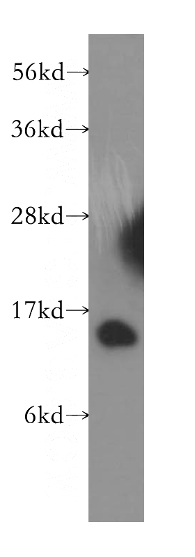 human liver tissue were subjected to SDS PAGE followed by western blot with Catalog No:112443(MAPKSP1 antibody) at dilution of 1:500