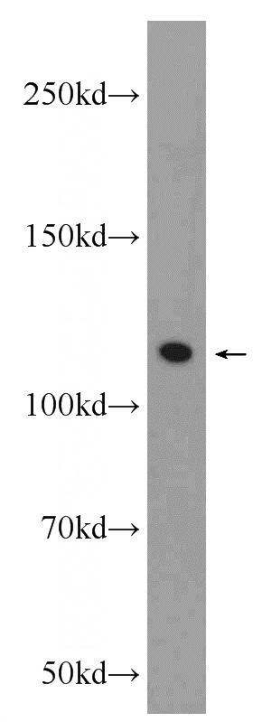 HEK-293 cells were subjected to SDS PAGE followed by western blot with Catalog No:113031(NCAPG Antibody) at dilution of 1:1500