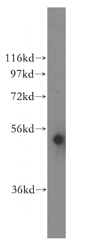 HEK-293 cells were subjected to SDS PAGE followed by western blot with Catalog No:109701(CYP3A5 antibody) at dilution of 1:400