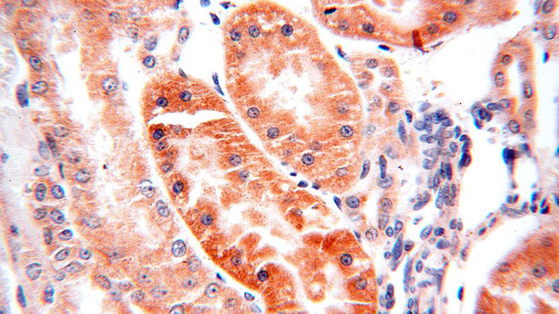Immunohistochemical of paraffin-embedded human kidney using Catalog No:115483(SNX5 antibody) at dilution of 1:100 (under 40x lens)