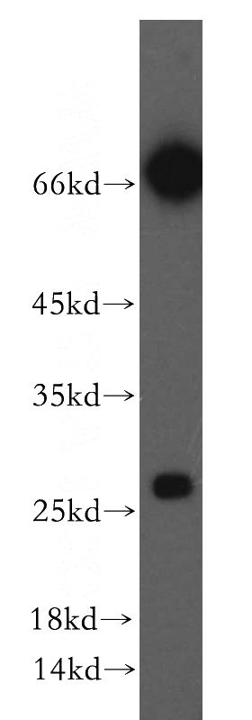HEK-293 cells were subjected to SDS PAGE followed by western blot with Catalog No:112020(KCTD15 antibody) at dilution of 1:500