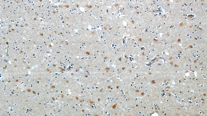 Immunohistochemical of paraffin-embedded human brain using Catalog No:107029(C9orf72 antibody) at dilution of 1:50 (under 10x lens)
