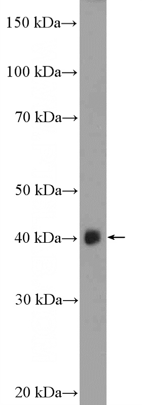 mouse skeletal muscle tissue were subjected to SDS PAGE followed by western blot with Catalog No:108213(ASB5 Antibody) at dilution of 1:300