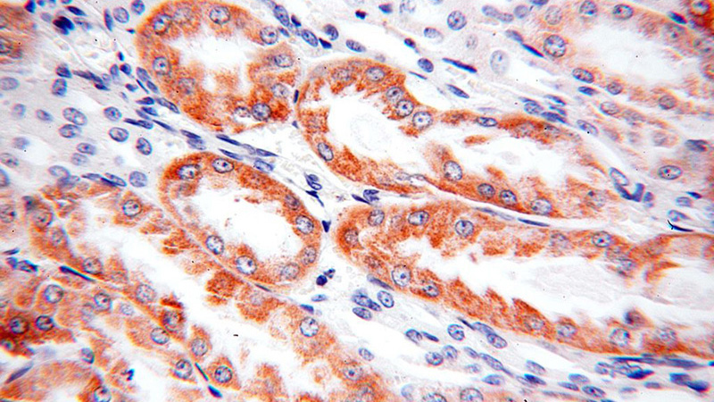 Immunohistochemical of paraffin-embedded human kidney using Catalog No:115320(SLC25A1 antibody) at dilution of 1:100 (under 40x lens)