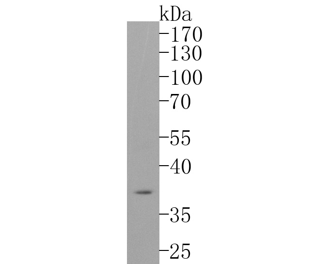Fig1:; Western blot analysis of CD68 on SH-SY5Y cell lysates. Proteins were transferred to a PVDF membrane and blocked with 5% BSA in PBS for 1 hour at room temperature. The primary antibody ( 1/500) was used in 5% BSA at room temperature for 2 hours. Goat Anti-Rabbit IgG - HRP Secondary Antibody (HA1001) at 1:5,000 dilution was used for 1 hour at room temperature.