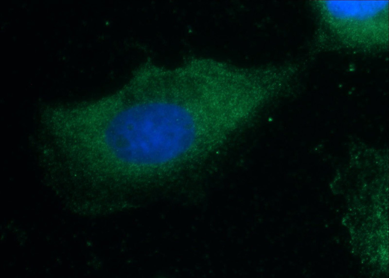 Immunofluorescent analysis of A431 cells using Catalog No:109003(CCL27 Antibody) at dilution of 1:25 and Alexa Fluor 488-congugated AffiniPure Goat Anti-Rabbit IgG(H+L)