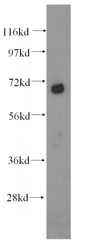 human liver tissue were subjected to SDS PAGE followed by western blot with Catalog No:109755(DCP1B antibody) at dilution of 1:500