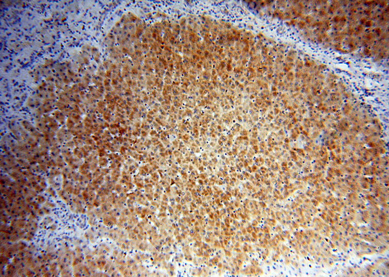 Immunohistochemical of paraffin-embedded human liver using Catalog No:113623(PDK1 antibody) at dilution of 1:50 (under 10x lens)