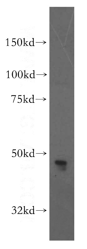 Jurkat cells were subjected to SDS PAGE followed by western blot with Catalog No:108813(CADM3 antibody) at dilution of 1:800