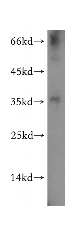 human testis tissue were subjected to SDS PAGE followed by western blot with Catalog No:113205(NKX3-1 antibody) at dilution of 1:800