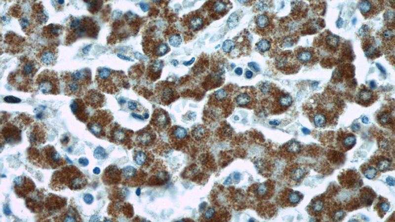 Immunohistochemical of paraffin-embedded human liver using Catalog No:110445(F12 antibody) at dilution of 1:50 (under 40x lens)