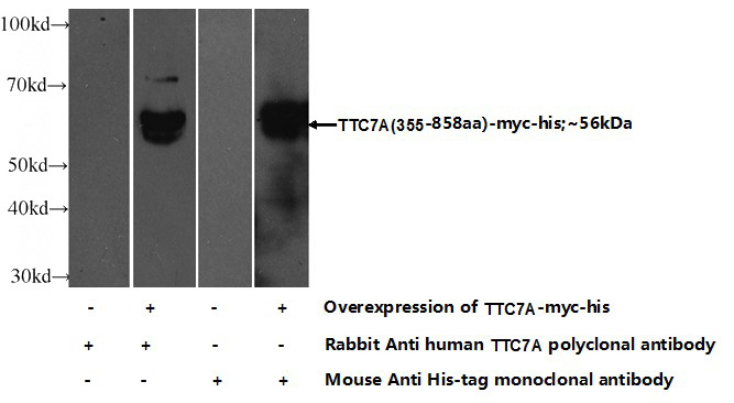 Transfected HEK-293 cells were subjected to SDS PAGE followed by western blot with Catalog No:116387(TTC7A Antibody) at dilution of 1:500