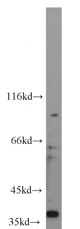 SKOV-3 cells were subjected to SDS PAGE followed by western blot with Catalog No:109177(CDX4 antibody) at dilution of 1:1000