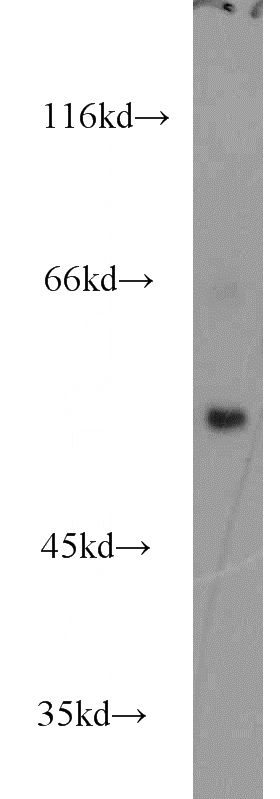 Jurkat cells were subjected to SDS PAGE followed by western blot with Catalog No:115479(SNX27 antibody) at dilution of 1:1200