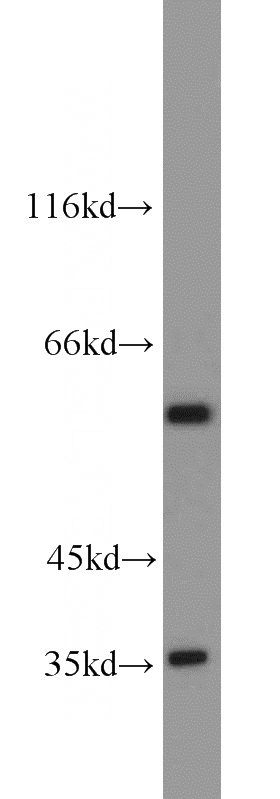 K-562 cells were subjected to SDS PAGE followed by western blot with Catalog No:110804(GABPA antibody) at dilution of 1:1000
