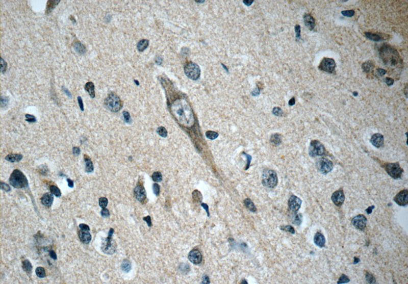 Immunohistochemistry of paraffin-embedded human brain slide using Catalog No:113330(OFD1 Antibody) at dilution of 1:50. (under 40x lens)