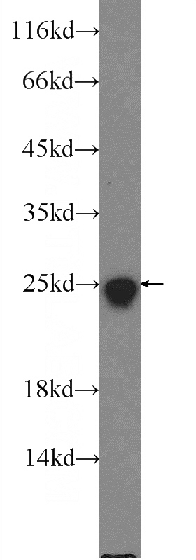 HeLa cells were subjected to SDS PAGE followed by western blot with Catalog No:115493(SOD2 antibody) at dilution of 1:1000