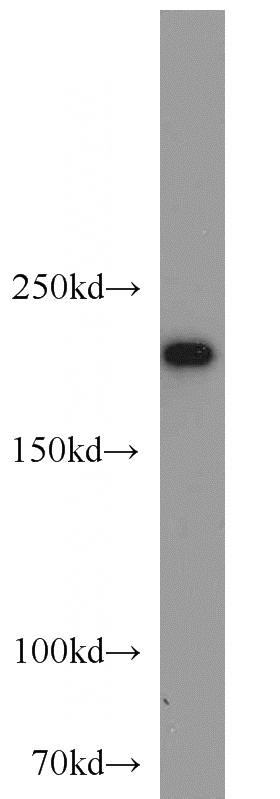 HeLa cells were subjected to SDS PAGE followed by western blot with Catalog No:115454(SNRNP200 antibody) at dilution of 1:1000