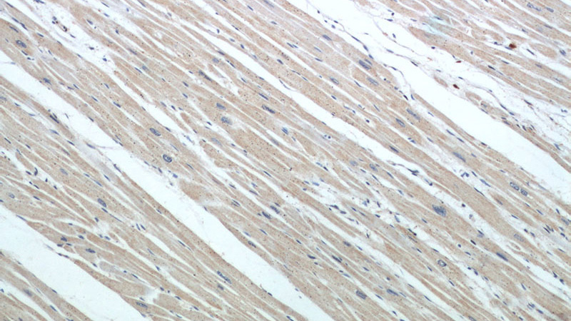 Immunohistochemical of paraffin-embedded human heart using Catalog No:114664(RHOT2 antibody) at dilution of 1:50 (under 10x lens)