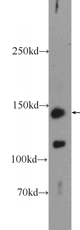 A431 cells were subjected to SDS PAGE followed by western blot with Catalog No:112513(MET Antibody) at dilution of 1:300