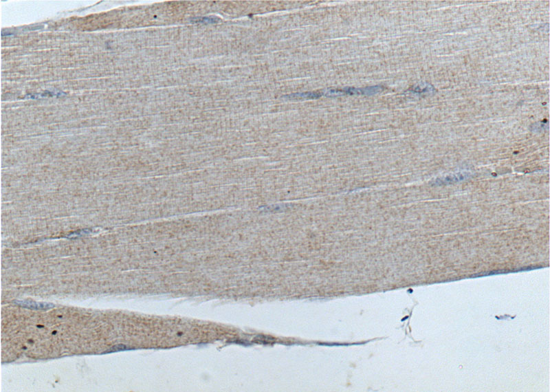 Immunohistochemistry of paraffin-embedded human skeletal muscle tissue slide using Catalog No:108301(ATP6 Antibody) at dilution of 1:200 (under 40x lens).