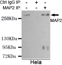Immunoprecipitation analysis of Hela cell lysates using MAP2 (N-terminus) mouse mAb.