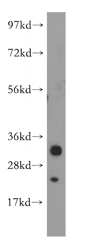 Jurkat cells were subjected to SDS PAGE followed by western blot with Catalog No:112761(MPZL2 antibody) at dilution of 1:800
