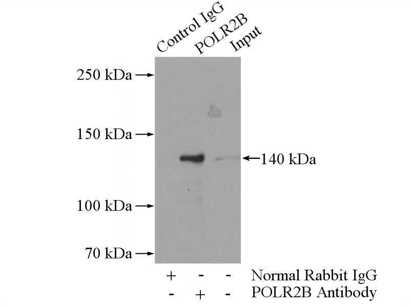 IP Result of anti-POLR2B-Specific (IP:Catalog No:114039, 4ug; Detection:Catalog No:114039 1:300) with HeLa cells lysate 1200ug.