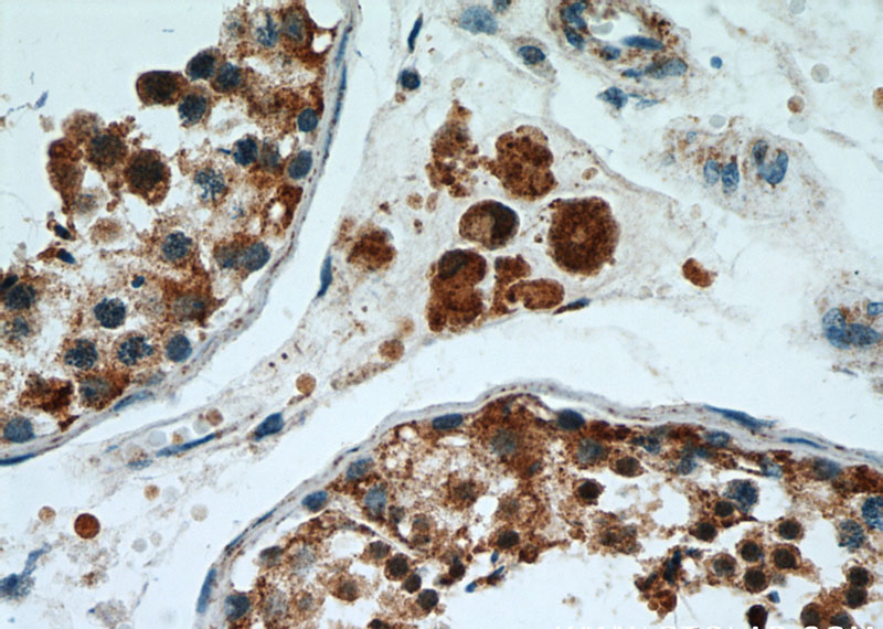 Immunohistochemical of paraffin-embedded human testis using Catalog No:114378(PSMA8 antibody) at dilution of 1:50 (under 40x lens)