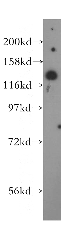 human brain tissue were subjected to SDS PAGE followed by western blot with Catalog No:107914(AGAP2 antibody) at dilution of 1:500