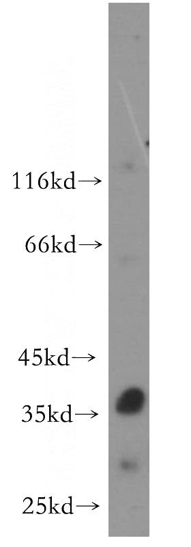 mouse thymus tissue were subjected to SDS PAGE followed by western blot with Catalog No:114730(RNASEH2B antibody) at dilution of 1:500