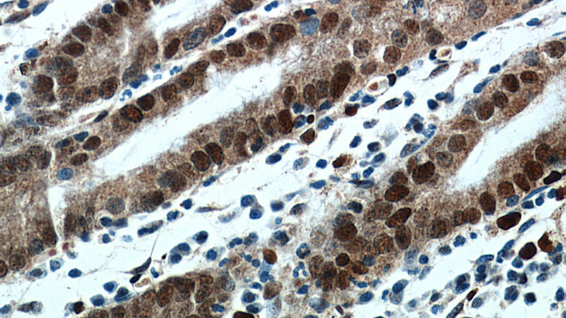 Immunohistochemical of paraffin-embedded human stomach using Catalog No:108792(C7orf58 antibody) at dilution of 1:100 (under 40x lens)