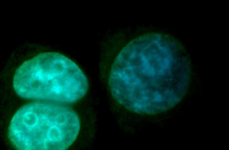 Immunofluorescent analysis of SH-SY5Y cells, using DGCR8 antibody Catalog No:109905 at 1:50 dilution and FITC-labeled donkey anti-rabbit IgG(green). Blue pseudocolor = DAPI (fluorescent DNA dye).