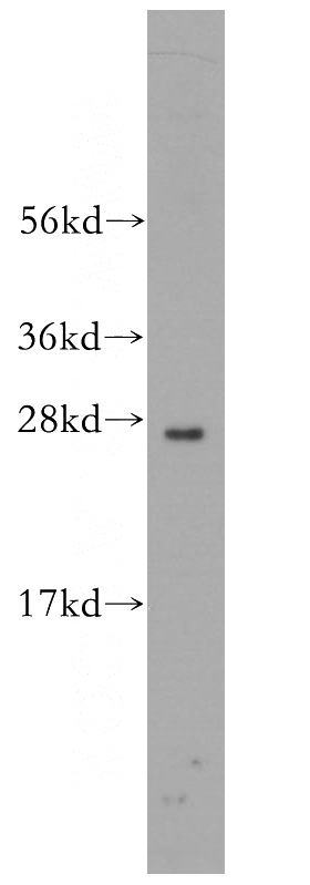 mouse uterus tissue were subjected to SDS PAGE followed by western blot with Catalog No:114733(RND2 antibody) at dilution of 1:300