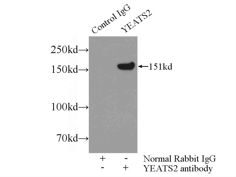 IP Result of anti-YEATS2 (IP:Catalog No:116883, 5ug; Detection:Catalog No:116883 1:300) with Jurkat cells lysate 2000ug.