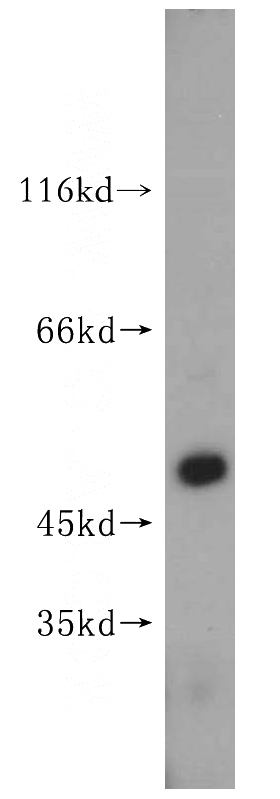 HepG2 cells were subjected to SDS PAGE followed by western blot with Catalog No:110516(FANCC antibody) at dilution of 1:200