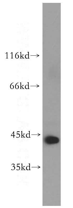 HeLa cells were subjected to SDS PAGE followed by western blot with Catalog No:108253(ARFIP1 antibody) at dilution of 1:500