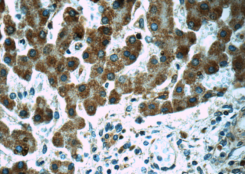 Immunohistochemistry of paraffin-embedded human liver tissue slide using Catalog No:114057(POMP Antibody) at dilution of 1:50