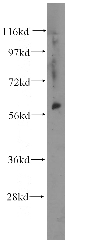 A549 cells were subjected to SDS PAGE followed by western blot with Catalog No:109826(DDX28 antibody) at dilution of 1:300