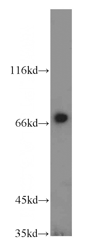 mouse kidney tissue were subjected to SDS PAGE followed by western blot with Catalog No:114410(RAB11FIP5 antibody) at dilution of 1:500