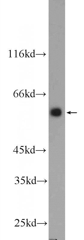 K-562 cells were subjected to SDS PAGE followed by western blot with Catalog No:110137(DYNC1LI1 Antibody) at dilution of 1:1000