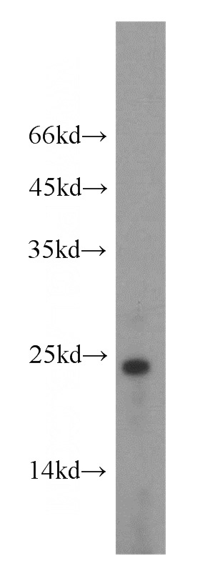 A549 cells were subjected to SDS PAGE followed by western blot with Catalog No:114304(PTHLH antibody) at dilution of 1:500