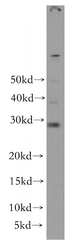 HeLa cells were subjected to SDS PAGE followed by western blot with Catalog No:114412(RAB12 antibody) at dilution of 1:500