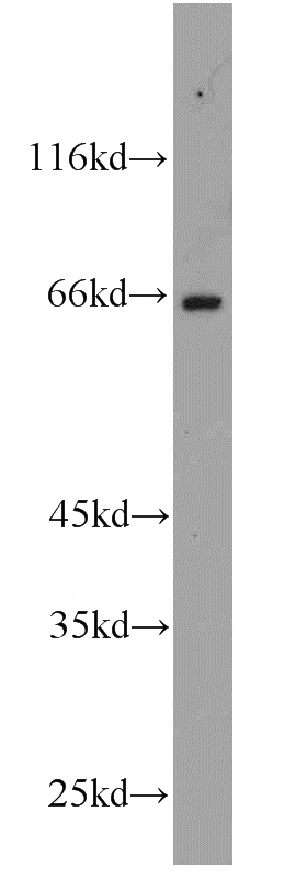 HeLa cells were subjected to SDS PAGE followed by western blot with Catalog No:110451(FAF1 antibody) at dilution of 1:1000