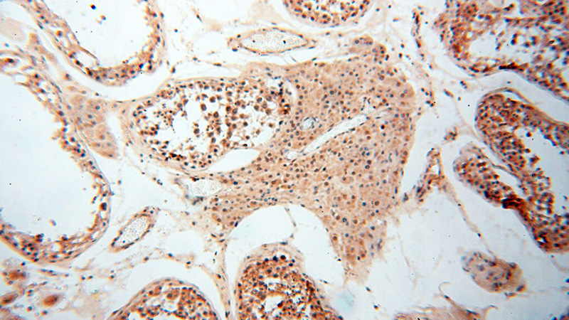 Immunohistochemical of paraffin-embedded human testis using Catalog No:115608(SSH3 antibody) at dilution of 1:100 (under 10x lens)