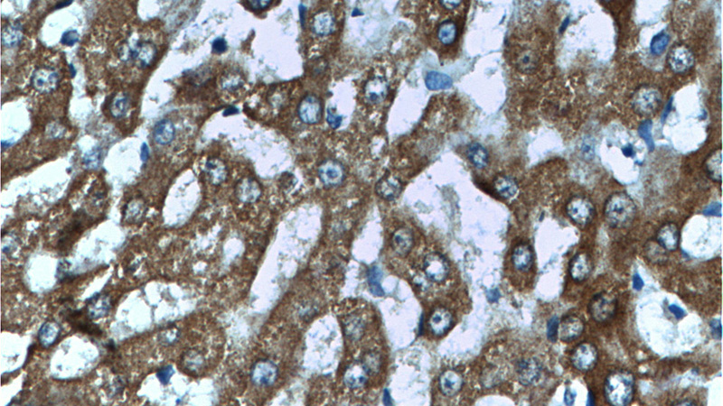 Immunohistochemistry of paraffin-embedded human liver tissue slide using Catalog No:111204(GRHPR Antibody) at dilution of 1:200 (under 40x lens)
