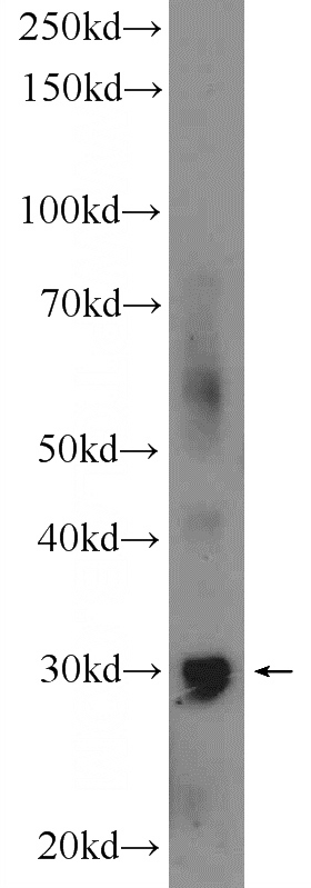 mouse brain tissue were subjected to SDS PAGE followed by western blot with Catalog No:110983(GIYD2 Antibody) at dilution of 1:600