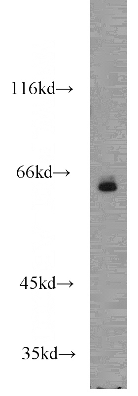 Jurkat cells were subjected to SDS PAGE followed by western blot with Catalog No:115988(TAF6L antibody) at dilution of 1:500
