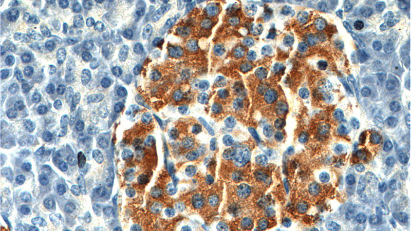 Immunohistochemistry of paraffin-embedded human pancreas tissue slide using Catalog No:112118(KRAP, SSFA2 Antibody) at dilution of 1:200 (under 40x lens).