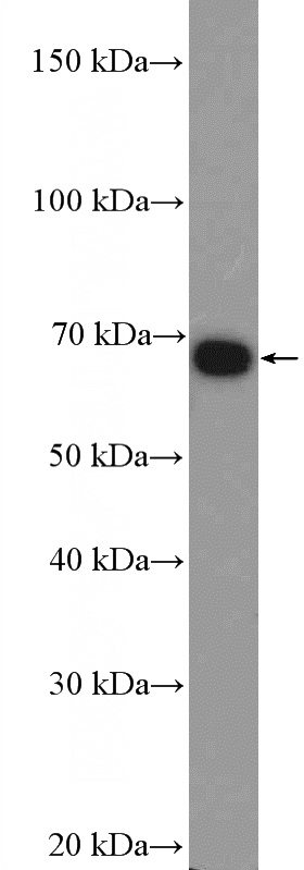 A431 cells were subjected to SDS PAGE followed by western blot with Catalog No:116913(ZBTB33 Antibody) at dilution of 1:100